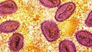Mpox Virus Neue Variante as monkeypox